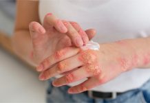 WHO publishes reports on fungal infections