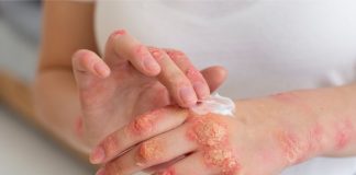 WHO publishes its first-ever reports on fungal infections WHO publishes reports on fungal infections